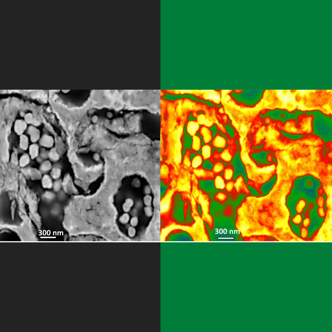 Imagen de microscopio electrónico de barrido (FESEM) por el tratamiento de consolidación con nanopartículas. A la derecha: Análisis digital de imagen resaltando los poros (verde) que son rellenados por las nanopartículas de forma redondeadas (Copyright: PAP-IGEO).